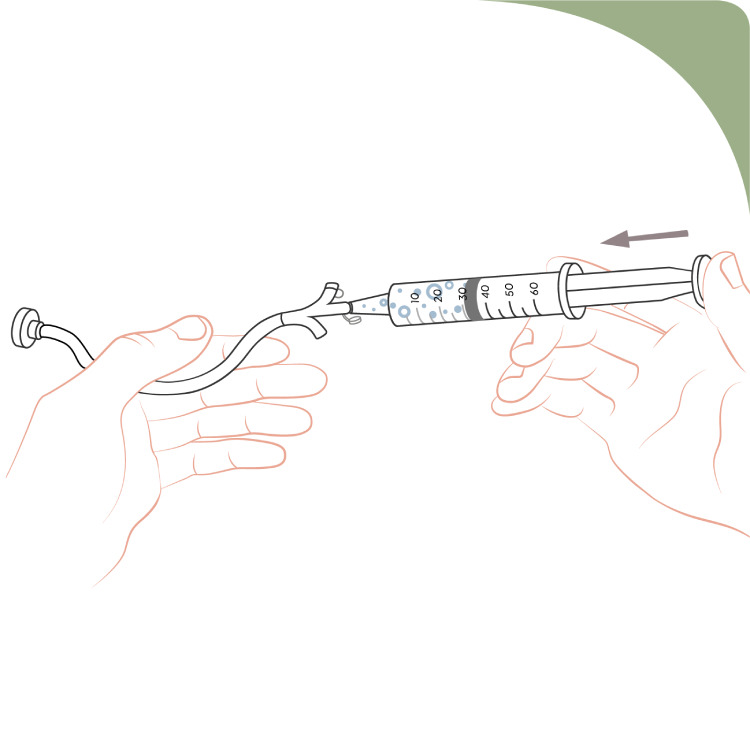 Illustration of AQNEURSA dosing via G-tube